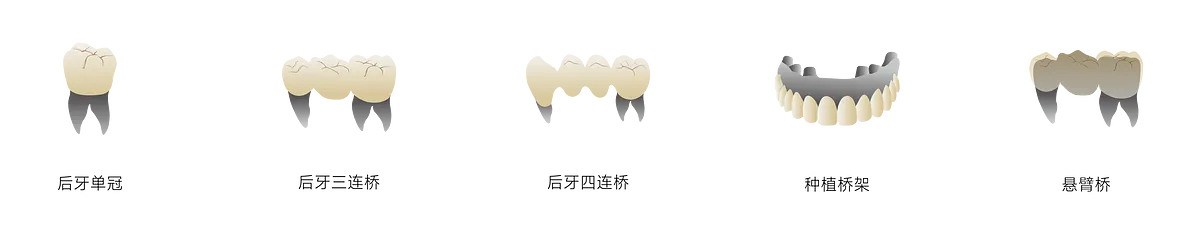 瓷倍健ST-ML_畫板 1 副本 3.webp